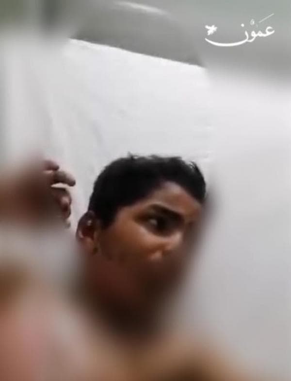 طفل يتعرض للحرق على يد زميليه داخل مدرسة في الرصيفة (فيديو)
