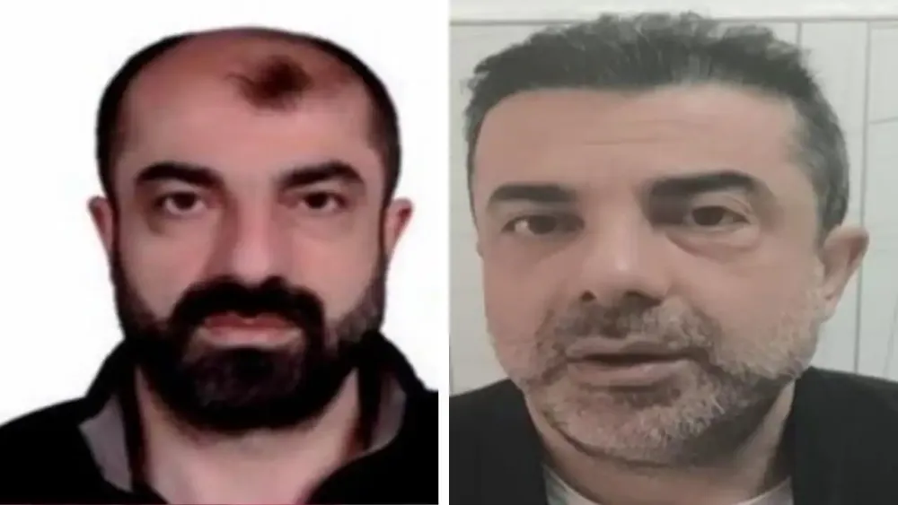 تركيا.. القبض على قاتل هارب غيّر ملامحه جذرياً