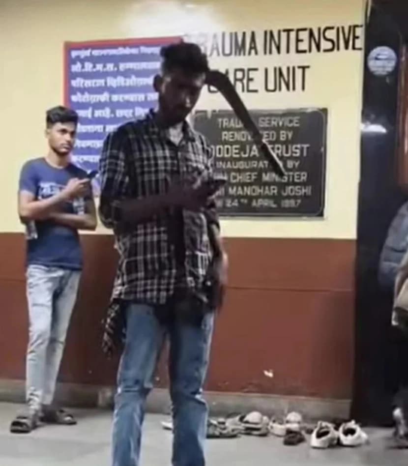 مومباي.. شاب يصدم الأطباء بساطور مغروس في رأسه